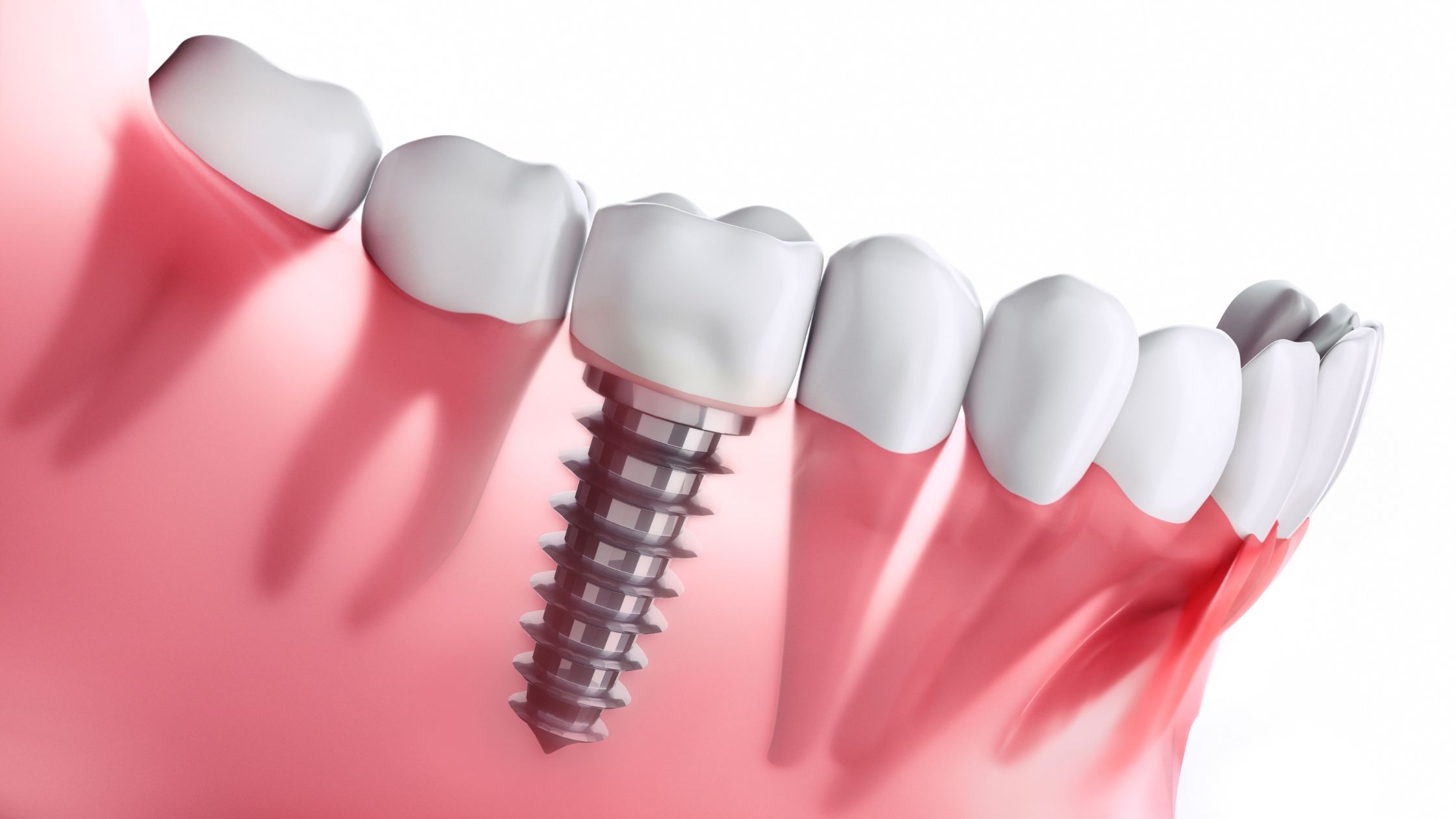 https://dental.netizens.dev/wp-content/uploads/2025/05/8.jpg