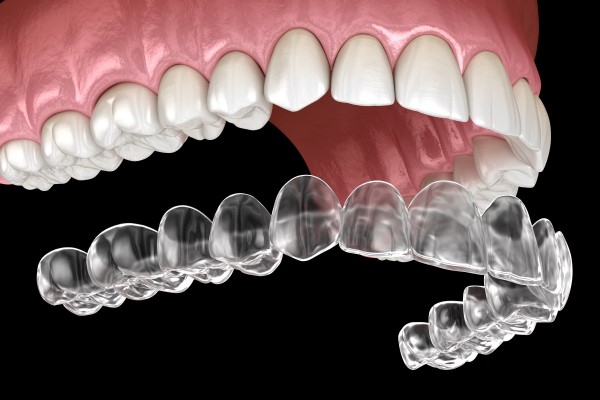 https://dental.netizens.dev/wp-content/uploads/2025/05/a5.jpg