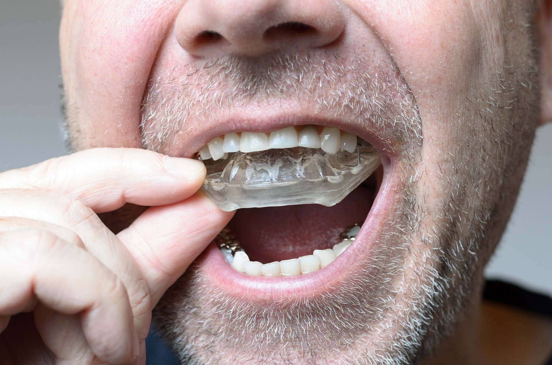 https://dental.netizens.dev/wp-content/uploads/2025/05/iStock-630006876-edited.jpg