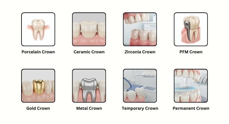 Types of crown
